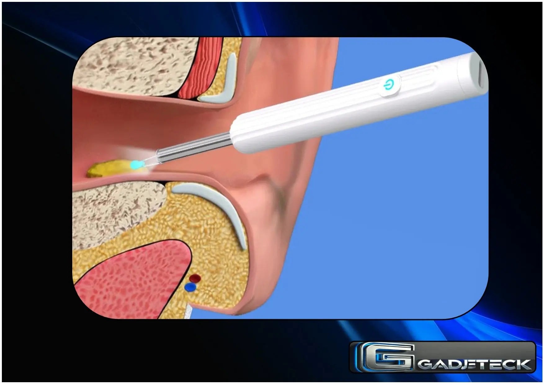 Nettoyeur d'oreilles intelligent et visuel avec caméra 1296P, cure-oreilles, chargement USB C, outil de retrait de cérumen, connexion Wi-Fi, 6 lumières LED - gadjeteck